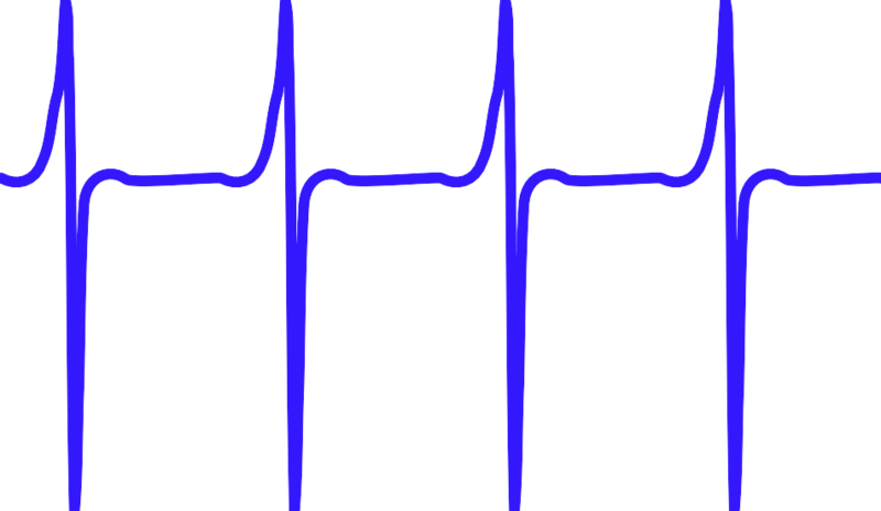 File:Elephantfish spike waveform.svg